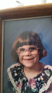 I lost my two front teeth before picture day